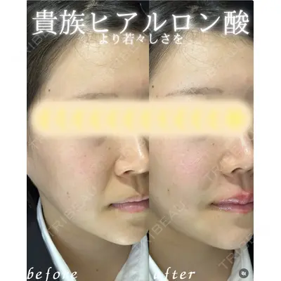 ルラライト美容クリニック 八王子院 桑野 淳医師の症例