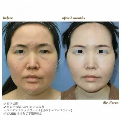 湘南美容クリニック 大阪梅田本院 岸 伽蓮　医師の症例