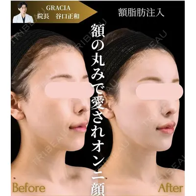 GRACIA clinic 【グラシアクリニック】 谷口　正和医師の症例