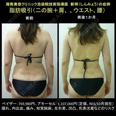 湘南美容クリニック 池袋東口院 新明 康宏医師の症例