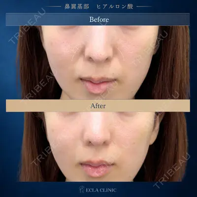 ECLA CLINIC (エクラクリニック) 緒方 善孝医師の症例