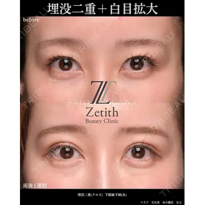 Zetith Beauty Clinic 銀座院 小川 悟史医師の症例