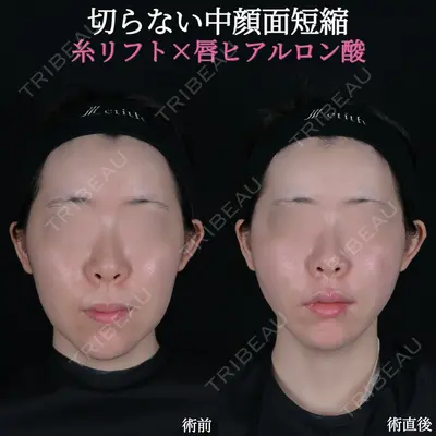Zetith Beauty Clinic 池袋院 沈 竟卉医師の症例