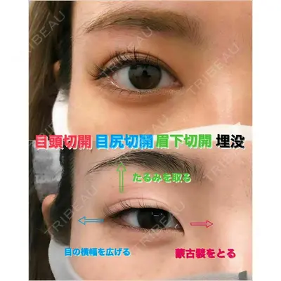 湘南美容クリニック 浜松院の症例