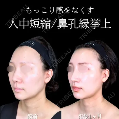 アリエル美容クリニック 大宮院 阪野 一世医師の症例