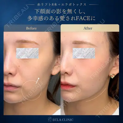 ECLA CLINIC (エクラクリニック) 緒方 善孝医師の症例