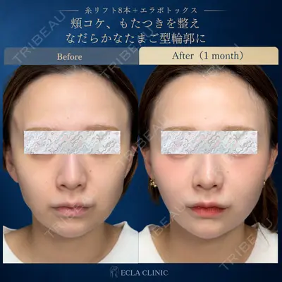 ECLA CLINIC (エクラクリニック) 緒方 善孝医師の症例