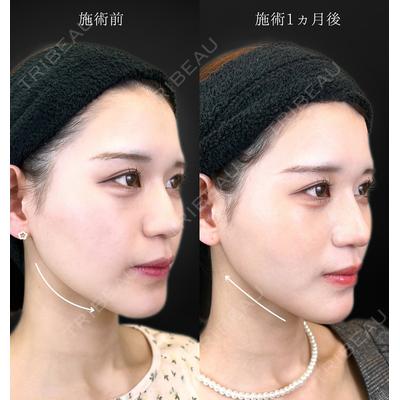 TCB東京中央美容外科 山梨甲府駅前院の症例