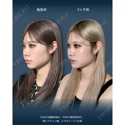 TCB東京中央美容外科 神戸院の症例