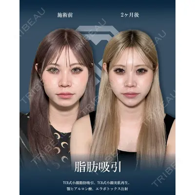 TCB東京中央美容外科 神戸院の症例