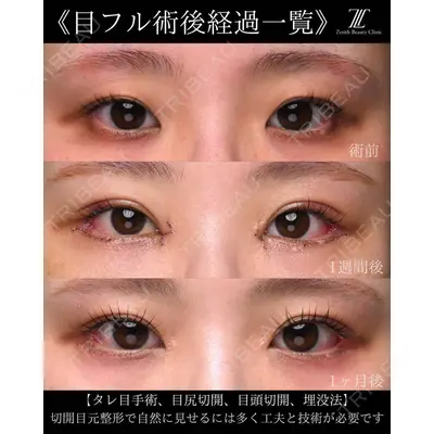 Zetith Beauty Clinic 大阪心斎橋院 楠本 拓哉医師の症例