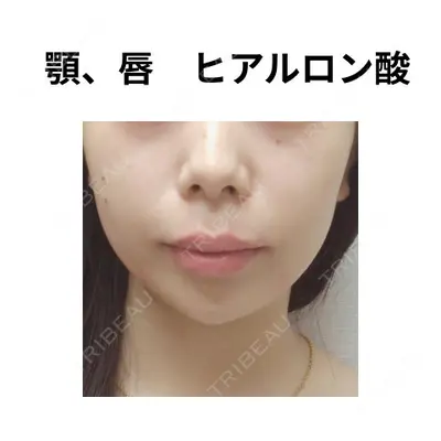 おおたかの森ビューティークリニック 海野 芙美香医師の症例