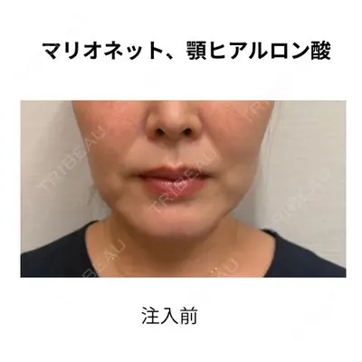 おおたかの森ビューティークリニック 海野 芙美香医師の症例