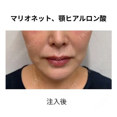 おおたかの森ビューティークリニック 海野 芙美香医師の症例