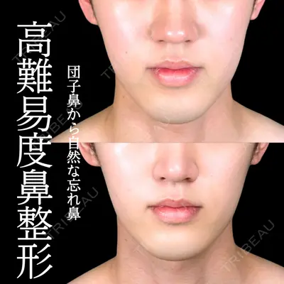 アリエル美容クリニック 大宮院 阪野 一世医師の症例