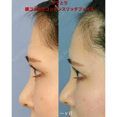 湘南美容クリニック 浜松院の症例