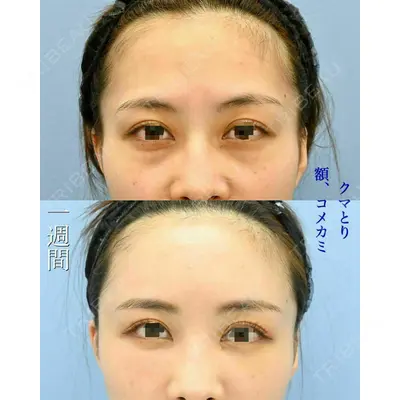 湘南美容クリニック 川崎院の症例