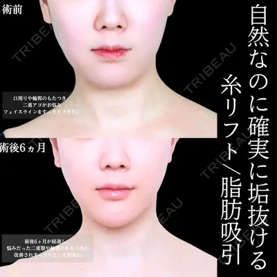 アリエル美容クリニック 大宮院 天白 典秀医師の症例