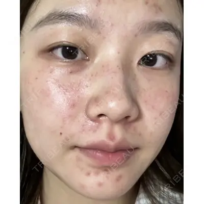 しんゆり美容健康クリニックの症例
