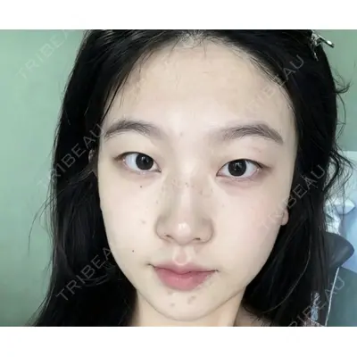 しんゆり美容健康クリニックの症例