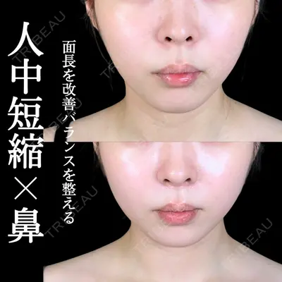 アリエル美容クリニック 大宮院 阪野 一世医師の症例
