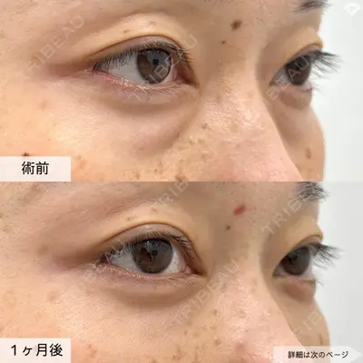 TCB東京中央美容外科 自由が丘院 北脇 大督医師の症例