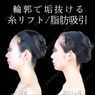 アリエル美容クリニック 大宮院 天白 典秀医師の症例