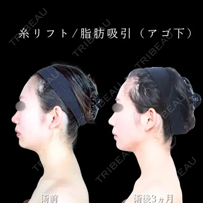 アリエル美容クリニック 大宮院 天白 典秀医師の症例