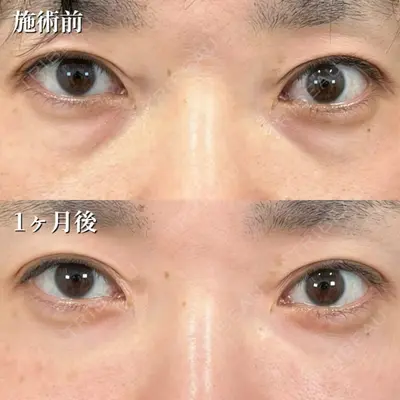 TCB東京中央美容外科 長野院 花岡 拓也医師の症例