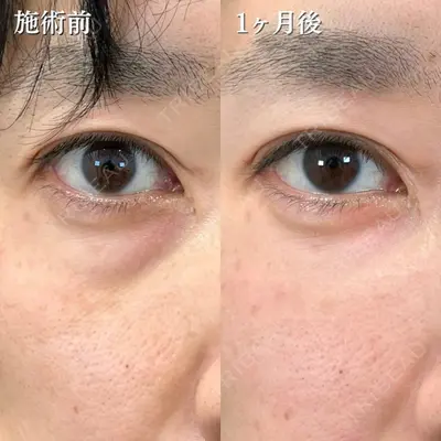 TCB東京中央美容外科 長野院 花岡 拓也医師の症例