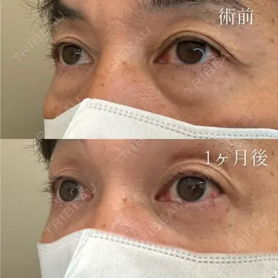 TCB東京中央美容外科 和歌山院 木原 俊輔医師の症例