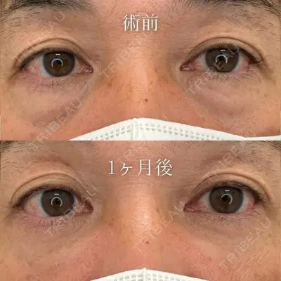 TCB東京中央美容外科 和歌山院 木原 俊輔医師の症例