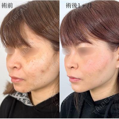 TCB東京中央美容外科 八王子院 森川 松次郎医師の症例