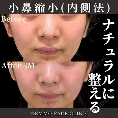 EMMO FACE CLINIC 東京三田院 木之下 哲彦医師の症例