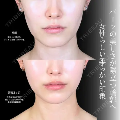 アリエル美容クリニック 大宮院 鈴木　桂介医師の症例