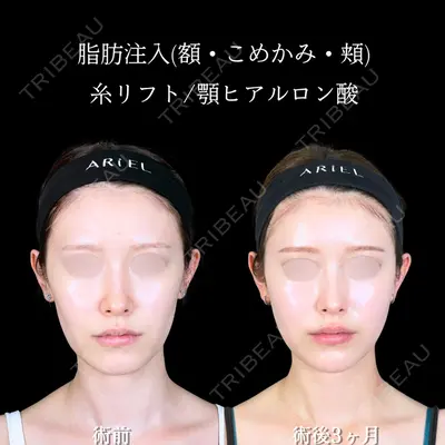 アリエル美容クリニック 大宮院 鈴木　桂介医師の症例