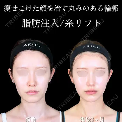 アリエル美容クリニック 大宮院 鈴木　桂介医師の症例
