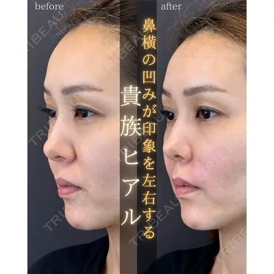 LA MER CLINIC 伊藤　整医師の症例