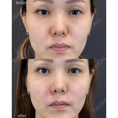 LA MER CLINIC 伊藤　整医師の症例