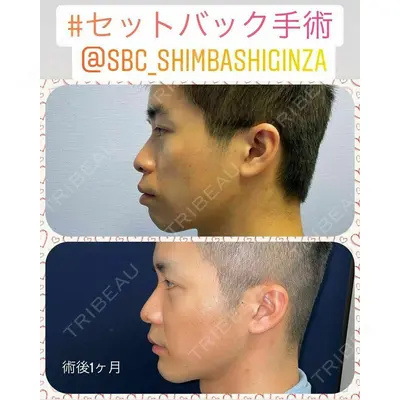 湘南美容クリニック 新橋銀座口院 内田 悠記医師の症例