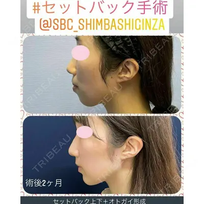 湘南美容クリニック 新橋銀座口院 内田 悠記医師の症例