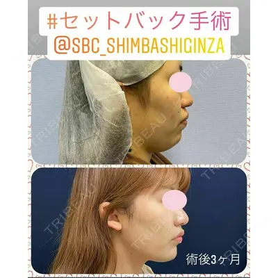 湘南美容クリニック 新橋銀座口院 内田 悠記医師の症例