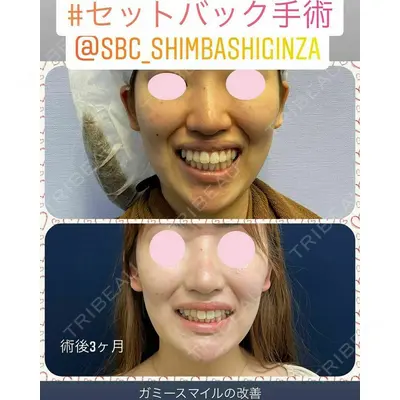 湘南美容クリニック 新橋銀座口院 内田 悠記医師の症例