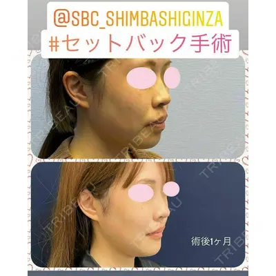 湘南美容クリニック 新橋銀座口院 内田 悠記医師の症例