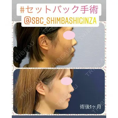 湘南美容クリニック 新橋銀座口院 内田 悠記医師の症例