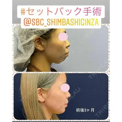 湘南美容クリニック 新橋銀座口院 内田 悠記医師の症例