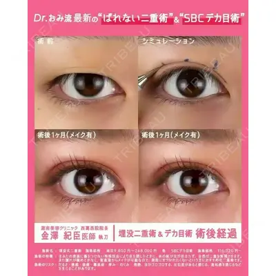 湘南美容クリニック 新橋銀座口院の症例