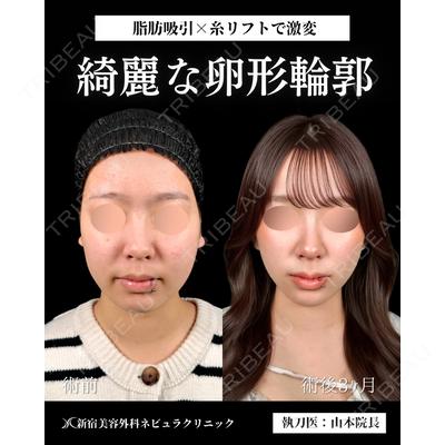 新宿美容外科ネビュラクリニック 山本 紘子医師の症例