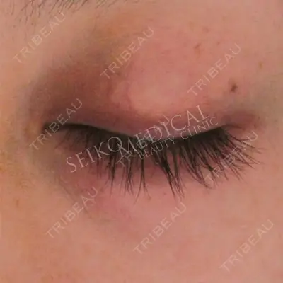 セイコメディカルビューティクリニック 鹿児島院 曽山　聖子医師の症例