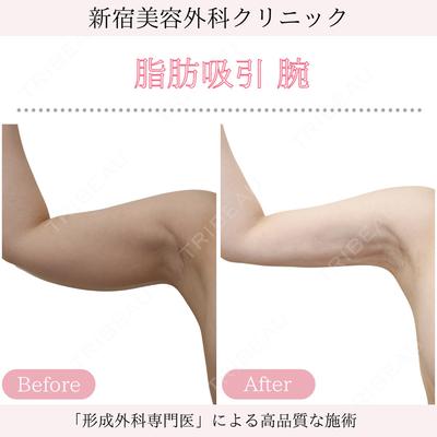 新宿美容外科クリニック 立川院の症例